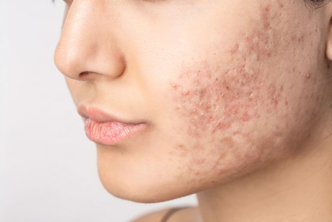dr-aparna-sahu-dermatologist-in-bhopal-skin-hair-care